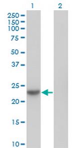 NME6 Monoclonal Antibody (2A10)