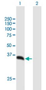 PSMD14 Polyclonal Antibody, MaxPab™