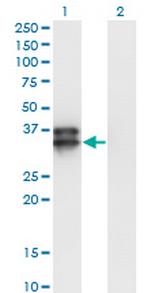 OLIG2 Monoclonal Antibody (2B11)