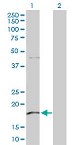 KLRG1 Antibody in Western Blot (WB)
