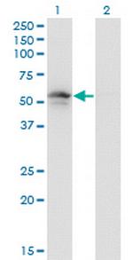 PLIN3 Monoclonal Antibody (2F7)