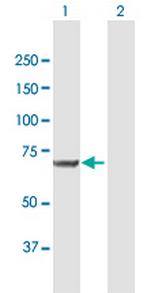 MSLN Antibody in Western Blot (WB)
