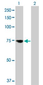 MSLN Antibody in Western Blot (WB)