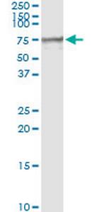 MSLN Monoclonal Antibody (1A10)