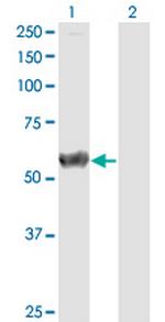 CALCOCO2 Monoclonal Antibody (3H6)