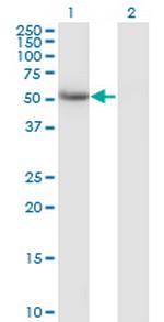 CALCOCO2 Antibody in Western Blot (WB)