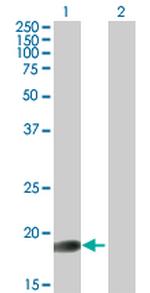 GLYAT Antibody in Western Blot (WB)