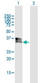 SPRY1 Polyclonal Antibody, MaxPab™