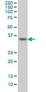 SPRY1 Monoclonal Antibody (3H4)