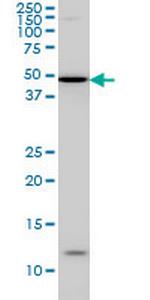 IRX5 Monoclonal Antibody (6B5)