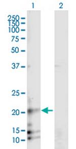 RAMP3 Polyclonal Antibody, MaxPab™