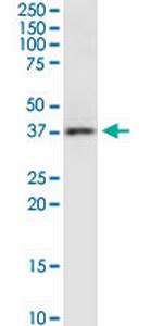 RAMP3 Monoclonal Antibody (1C11)