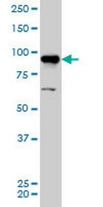 AKAP8 Monoclonal Antibody (3D4)