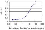 STUB1 Monoclonal Antibody (2E12)