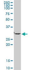 SMNDC1 Polyclonal Antibody, MaxPab™