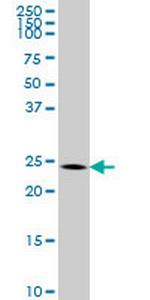BCAS2 Monoclonal Antibody (1D10)