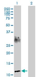 SPEG Antibody in Western Blot (WB)