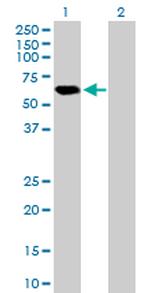 APBB3 Antibody in Western Blot (WB)