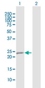 RTN3 Polyclonal Antibody, MaxPab™