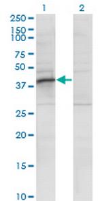 RRAGB Monoclonal Antibody (2B8)