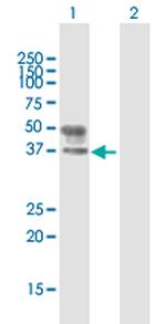 B3GNT3 Polyclonal Antibody, MaxPab™