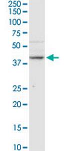 B3GNT3 Polyclonal Antibody, MaxPab™
