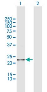 WARS2 Polyclonal Antibody, MaxPab™