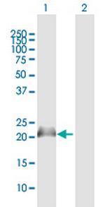 NPM3 Antibody in Western Blot (WB)