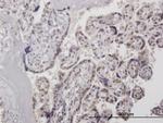 HMG20A Antibody in Immunohistochemistry (Paraffin) (IHC (P))