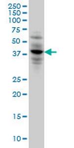 CACNG3 Monoclonal Antibody (3E4)