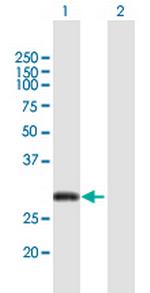 CITED2 Polyclonal Antibody, MaxPab™