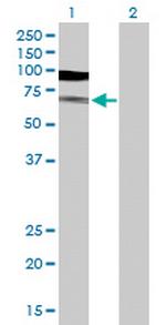 TUBA1B Antibody in Western Blot (WB)