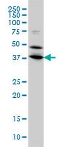 BPNT1 Monoclonal Antibody (2E1)
