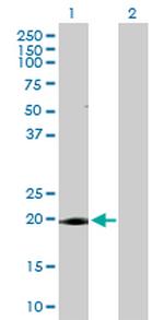 ANAPC10 Polyclonal Antibody, MaxPab™