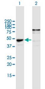 NDRG1 Polyclonal Antibody, MaxPab™