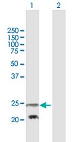 PEMT Polyclonal Antibody, MaxPab™