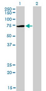 PIAS3 Monoclonal Antibody (4F12)