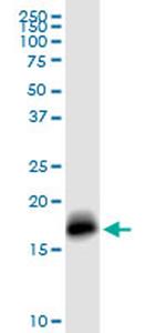 IFITM3 Antibody in Western Blot (WB)