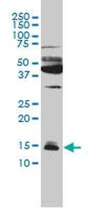 IFITM3 Monoclonal Antibody (4C8-1B10)