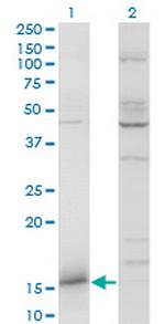 IFITM3 Monoclonal Antibody (2H4-1D5)