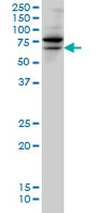 TESK2 Antibody in Western Blot (WB)