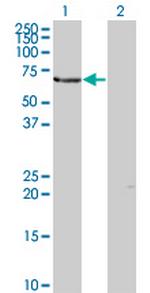 TESK2 Monoclonal Antibody (5D1)