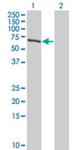 TESK2 Antibody in Western Blot (WB)