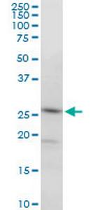 PGRMC2 Antibody in Western Blot (WB)