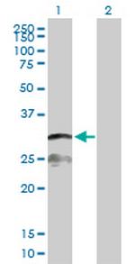 IFI30 Antibody in Western Blot (WB)