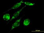PECI Antibody in Immunocytochemistry (ICC/IF)