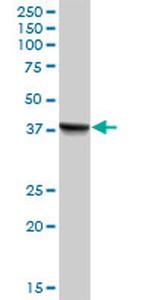 PECI Antibody in Western Blot (WB)