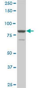 TACC3 Monoclonal Antibody (6C4)