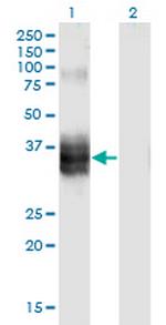 FST Monoclonal Antibody (4B11)
