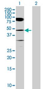 TADA3L Polyclonal Antibody, MaxPab™